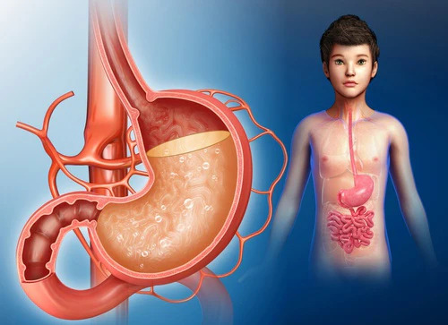 Best Gastric Problems Treatment in Ghaziabad