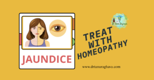JAUNDICE AND HOMEOPATHY