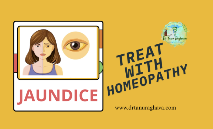 JAUNDICE AND HOMEOPATHY