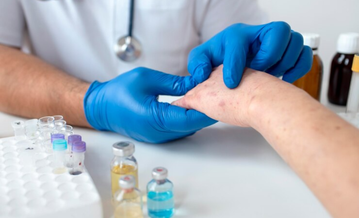 Skin Diseases Treatment in Ghaziabad