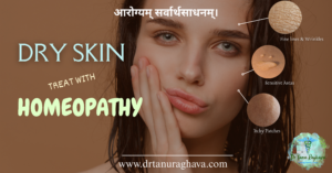 dry skin