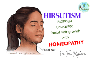 hirsutism and homeopathy treatment