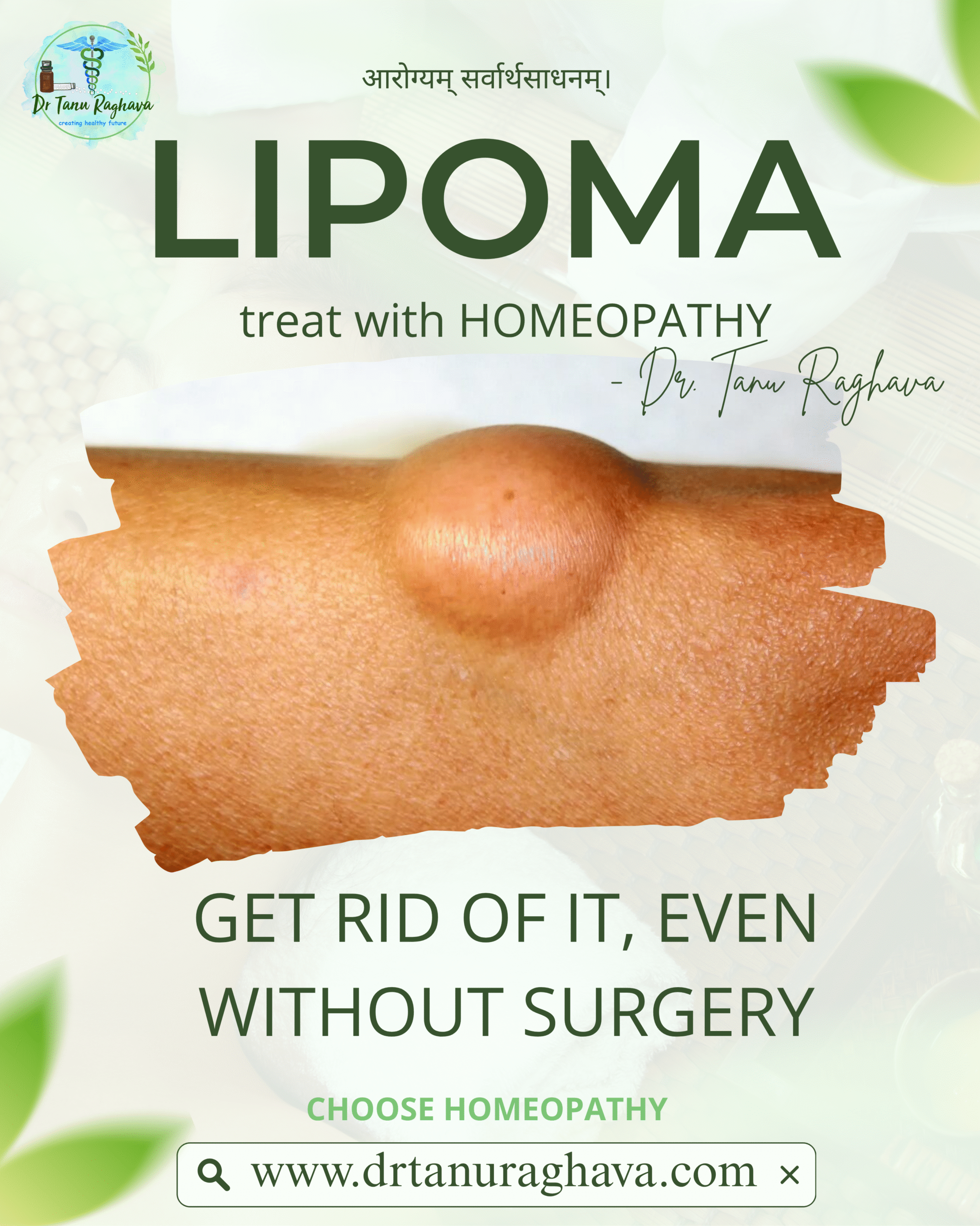 TREAT LIPOMA WITH HOMEOPATHY