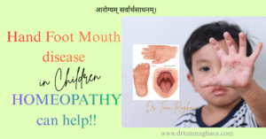 hand foot mouth disease in children