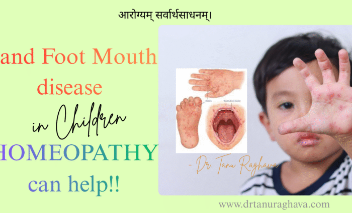 hand foot mouth disease in children