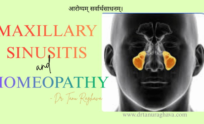 Maxillary Sinus Homeopathy Treatment