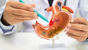 GERD treatment in Vaishali